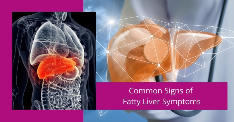 Common Signs of Fatty Liver Symptoms