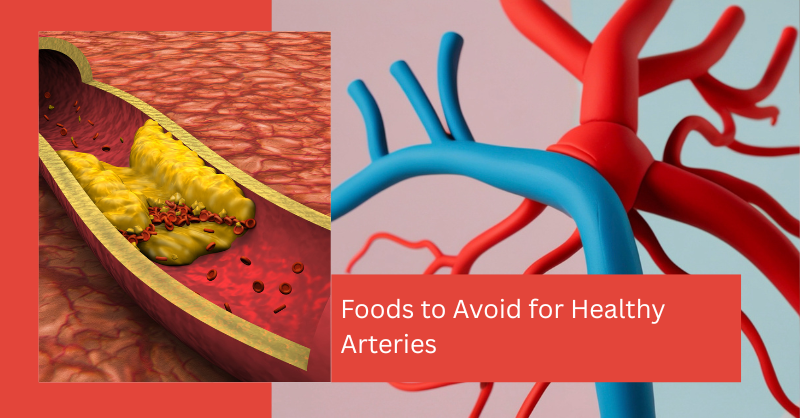 Foods to Avoid for Healthy Arteries