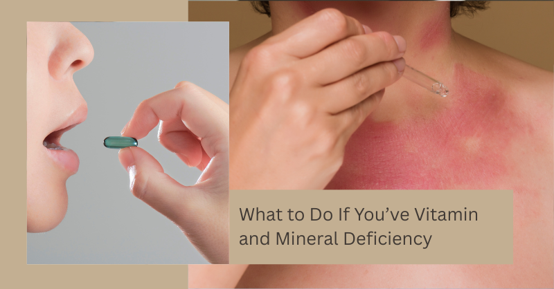 What to Do If You’ve Vitamin and Mineral Deficiency